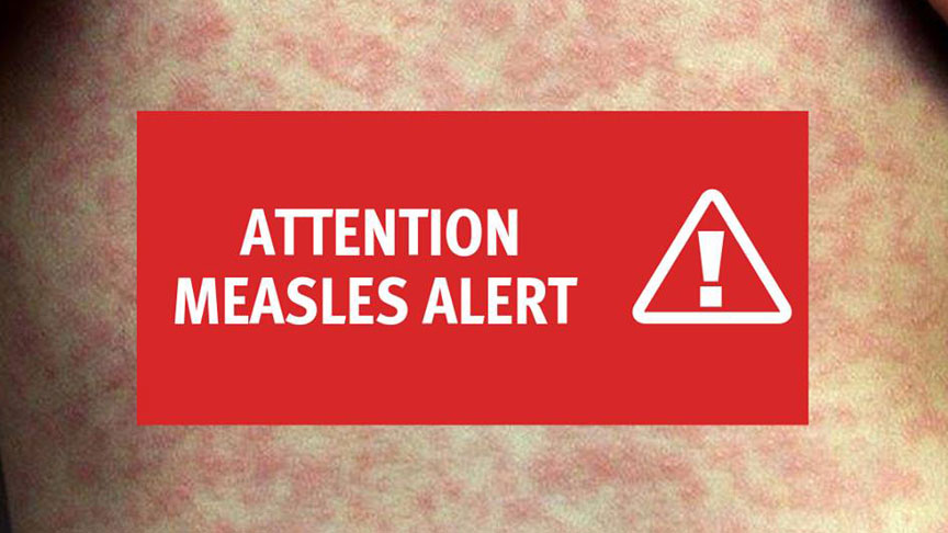 Measles Alert 